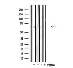 CDKAL1 Antibody in Western Blot (WB)