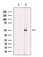 CYP2J2 Antibody in Western Blot (WB)