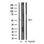 CYP2J2 Antibody in Western Blot (WB)