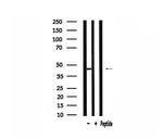 AGPAT5 Antibody in Western Blot (WB)