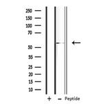 PSMD12 Antibody in Western Blot (WB)