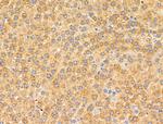 MRPL11 Antibody in Immunohistochemistry (Paraffin) (IHC (P))