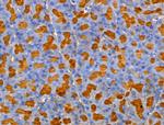 MRPL44 Antibody in Immunohistochemistry (Paraffin) (IHC (P))