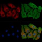 RPS18 Antibody in Immunocytochemistry (ICC/IF)