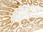 RPS18 Antibody in Immunohistochemistry (Paraffin) (IHC (P))