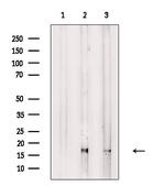 RPS18 Antibody in Western Blot (WB)