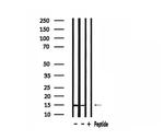 RPS19 Antibody in Western Blot (WB)