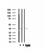 RPL5 Antibody in Western Blot (WB)