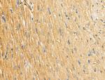 ABHD2 Antibody in Immunohistochemistry (Paraffin) (IHC (P))