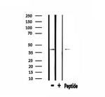 ABHD7 Antibody in Western Blot (WB)