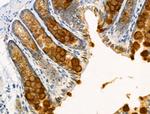 ACSS2 Antibody in Immunohistochemistry (Paraffin) (IHC (P))