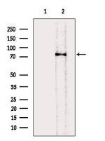 ACSS2 Antibody in Western Blot (WB)