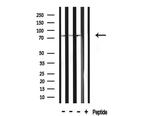 ACSS2 Antibody in Western Blot (WB)