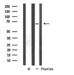 SLC33A1 Antibody in Western Blot (WB)