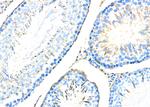 ADAM32 Antibody in Immunohistochemistry (Paraffin) (IHC (P))