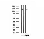 ADAMTS19 Antibody in Western Blot (WB)