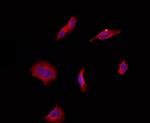 ARF4 Antibody in Immunocytochemistry (ICC/IF)