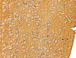 AKR1E2 Antibody in Immunohistochemistry (Paraffin) (IHC (P))