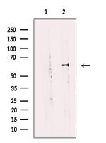 Arylsulfatase E Antibody in Western Blot (WB)