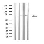 Arylsulfatase E Antibody in Western Blot (WB)