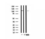 ATXN2L Antibody in Western Blot (WB)