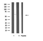 ATP5A1 Antibody in Western Blot (WB)