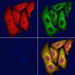 ABCA6 Antibody in Immunocytochemistry (ICC/IF)