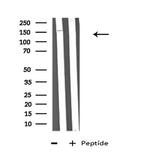 ABCA6 Antibody in Western Blot (WB)