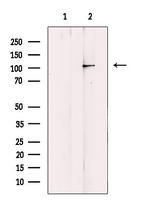 EPB41L2 Antibody in Western Blot (WB)