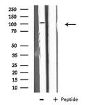 EPB41L2 Antibody in Western Blot (WB)