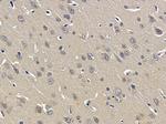 BOK Antibody in Immunohistochemistry (Paraffin) (IHC (P))