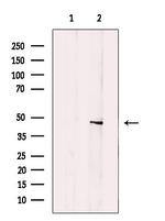 B4GALT1 Antibody in Western Blot (WB)