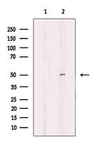 B4GALT3 Antibody in Western Blot (WB)