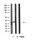 KCNMB2 Antibody in Western Blot (WB)