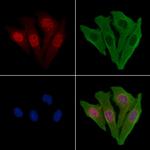 Calpain 10 Antibody in Immunocytochemistry (ICC/IF)