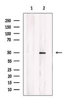 CHST1 Antibody in Western Blot (WB)