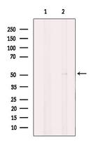 Carboxypeptidase M Antibody in Western Blot (WB)