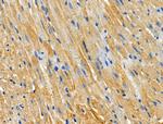 CHSY1 Antibody in Immunohistochemistry (Paraffin) (IHC (P))