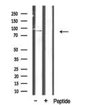 CHSY1 Antibody in Western Blot (WB)