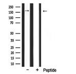 CLASP1 Antibody in Western Blot (WB)