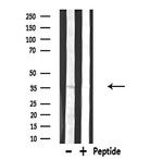 DGAT2L6 Antibody in Western Blot (WB)