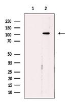 POLR1B Antibody in Western Blot (WB)