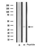 RNF144B Antibody in Western Blot (WB)