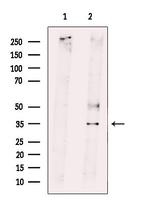 RNF144B Antibody in Western Blot (WB)