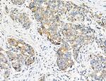 eIF5B Antibody in Immunohistochemistry (Paraffin) (IHC (P))