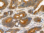 eIF5B Antibody in Immunohistochemistry (Paraffin) (IHC (P))