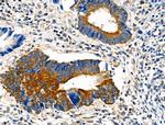 eIF5B Antibody in Immunohistochemistry (Paraffin) (IHC (P))