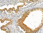 eIF5B Antibody in Immunohistochemistry (Paraffin) (IHC (P))