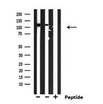 eIF5B Antibody in Western Blot (WB)