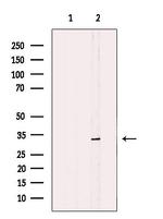 MAD2L1BP Antibody in Western Blot (WB)